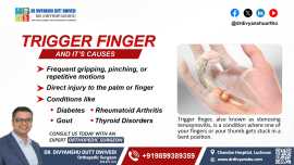 Trigger Finger and It’s Causes , Lucknow