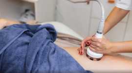 CoolSculpting Orlando Sculpt and Contour Your Body, Winter Park