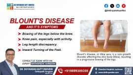 Blount's Disease And Its Symptoms, Lucknow