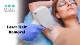 Laser Hair Removal In Bangalore, Bengaluru
