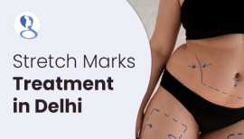 Mommy Makeover Surgery in Jaipur, Jaipur