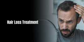Hair Loss Treatment In Bangalore, Bengaluru