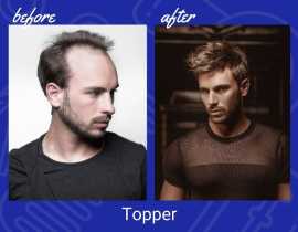 Buy Stylish Hair Pieces for Men to Enhance Your Lo, Chicago