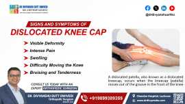 Signs and Symptoms of a Dislocated Knee Cap, Lucknow