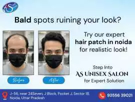 Transform Your Look with Hair Patch in Noida., Noida
