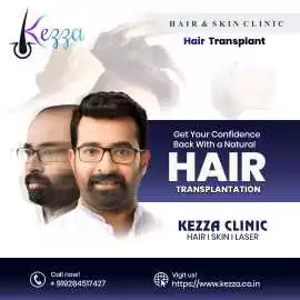 Kezza Clinic – Best Hair Transplant & Skin Car, Jaipur
