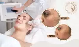 Trusted Skin Care Clinic in Mississauga, Mississauga