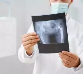 Find Fast Access to Hip Replacement Surgery Calgar, Vancouver