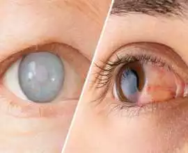 Affordable Eye Treatment in Andul - Dristipath Eye, Kolkata