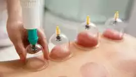 Hijama Therapy in Dubai – Restore Balance, Dubai