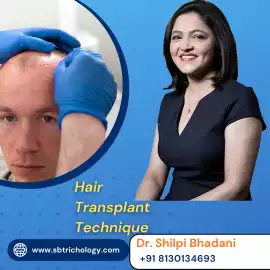 Advanced Hair Transplant Technique | FUE, Hair-Art, Gurgaon