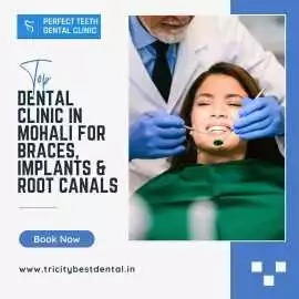 Top Dental Clinic in Mohali for Braces & Impla, Mohali