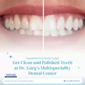 Get Clean and Polished Teeth at DentalClinicDelhi, New Delhi
