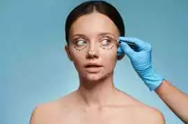 Feel Refreshed with Eyelid Surgery in Richmond, Richmond