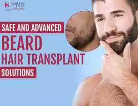Beard Hair Transplant in Mumbai, Mumbai