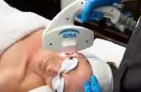 Clear Skin Results with Spider Vein Treatment, Cape Town