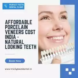 Affordable Porcelain Veneers Cost India, Mohali