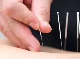 Bryant Park Acupuncture & Holistic Wellness.., New York